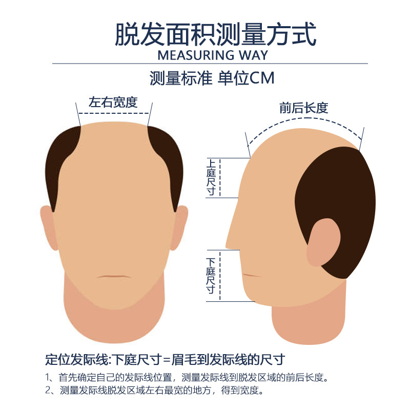 男士假发仿生头旋双递针真人发发补发片#1自然黑